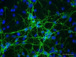 Abcam Rabbit polyclonal to EAAT2, Quantity: Each of 1