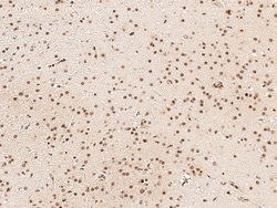 Sino Biological Anti-NCOR2 Antibody, Rabbit Polyclonal, Quantity: Each