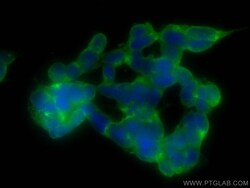 NF-L Rabbit, anti-Human, CoraLite Plus 488, Polyclonal, Proteintech 20 &mu;L | Buy Online | Proteintech | Fisher Scientific