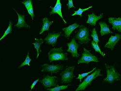 Sino Biological NGFR Antibody, Rabbit MAb 100µL, Quantity: Each of 1