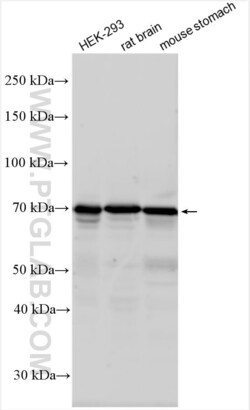 NHE2 Rabbit, anti-Human, Polyclonal, Proteintech Quantity: 150 &mu;L:Antibodies