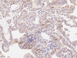 Sino Biological Anti-nkx6.1 Antibody, Rabbit Polyclonal, Quantity: Each