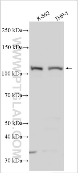 NLRP7 Rabbit, anti-Human, Polyclonal, Proteintech Quantity: 150 &mu;L:Antibodies