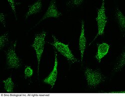 Sino Biological Anti-NOS2/iNOS Antibody, Rabbit Polyclonal, Quantity: Each