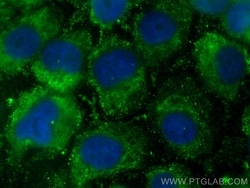 NOXA2/p67phox Mouse, anti-Human, CoraLite Plus 488, Clone: 1D11A3, Proteintech:Antibodies:Primary