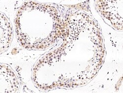 Sino Biological Anti-Dax1 Antibody, Rabbit Polyclonal, Quantity: Each of