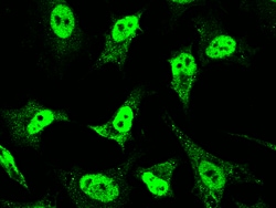 Sino Biological Anti-Mineralocorticoid Receptor/NR3C2 Antibody, Rabbit