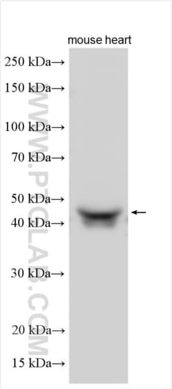 NT5C1A Rabbit, anti-Human, Polyclonal, Proteintech:Antibodies:Primary Antibodies