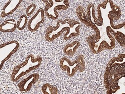 Sino Biological Anti-OBFC1 Antibody, Rabbit Polyclonal, Quantity: Each