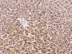 Sino Biological Anti-OFD1 Antibody, Rabbit Polyclonal, Quantity: Each of