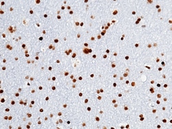 Sino Biological Human OLIG2 MAb 20ul (Sino Biological), Quantity: Each