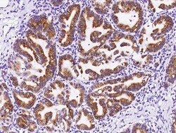 Sino Biological Anti-OPHN1 Antibody, Rabbit Polyclonal, Quantity: Each
