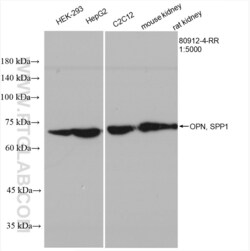 OPN, SPP1 Rabbit, anti-Human, Clone: 6B11, Proteintech Quantity: 20 &mu;L:Antikörper