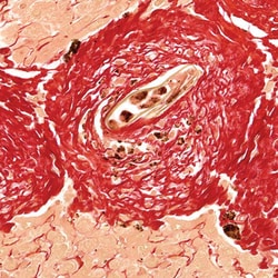 Polysciences, Inc. Picrosirius Red Stain Kit, 500 mL, Quantity: Each of