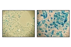 Cell Signaling Technology Senescence beta-Galactosidase Staining Kit 1