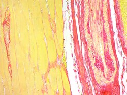 Abcam Picro Sirius Red Stain Kit (Connective Tissue Stain), Quantity: Each