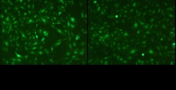 Angio Proteomie GFP Expressing Human Umbilical Vein Endothelial Cells,
