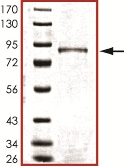 Sino Biological&nbsp;Recombinant Human TP73/p73 Protein (Full Length, GST Tag)