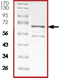 Sino Biological&nbsp;Recombinant Human KAT2B/PCAF Protein (GST Tag)