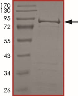 Sino Biological&nbsp;Recombinant Human PCTK2 Protein (Full Length, GST Tag)
