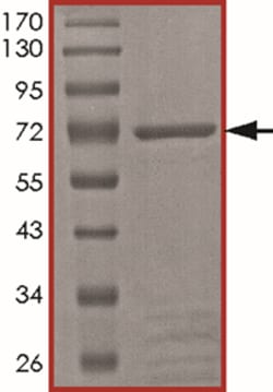 Sino Biological&nbsp;Recombinant Human PFTK1/CDK14 Protein (Full Length, GST Tag)