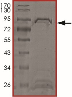 Sino Biological&nbsp;Recombinant Human PPP2R1B Protein (Full Length, GST Tag)