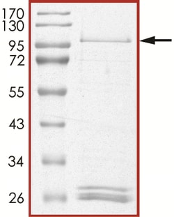 Sino Biological&nbsp;Recombinant Human PIP5K3/PIKFYVE Protein (GST Tag)