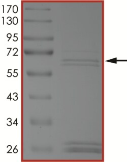 Sino Biological&nbsp;Recombinant Human PARK2/Parkin Protein (Full Length, GST Tag)