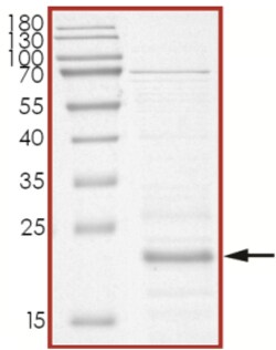 Sino Biological&nbsp;Recombinant Human PARK7/DJ-1 Protein (His Tag)