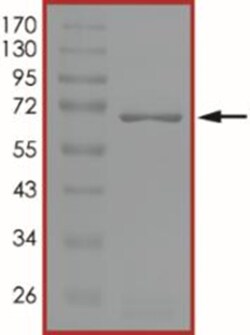 Sino Biological&nbsp;Recombinant Human PPME1 Protein (GST Tag)