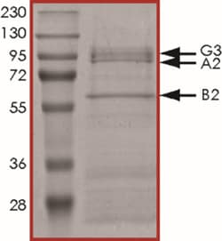 Sino Biological&nbsp;Recombinant Human AMPK (A2/B2/G3) Heterotrimer Protein (Full Length, A2/B2/G3, His & GST Tag)