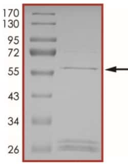 Sino Biological&nbsp;Recombinant Human PSMD14 Protein (Full Length, GST Tag)