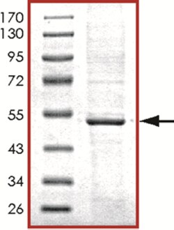 Sino Biological&nbsp;Recombinant Human PRKAR1A Protein (Full Length, His Tag)
