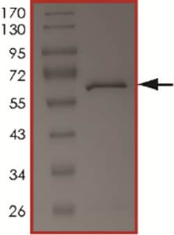 Sino Biological&nbsp;Recombinant Human TWF2/PTK9L Protein (Full Length, GST Tag)