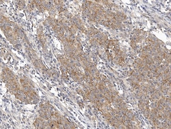 Sino Biological PABPC1 Antibody, Rabbit PAb, Antigen Affinity Purified