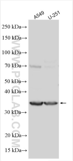 PABPC5 Rabbit, anti-Human, Polyclonal, Proteintech Quantity: 20 &mu;L:Antibodies