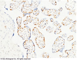 Sino Biological PARP-1 / PARP Antibody, Mouse MAb 100uL, Quantity: Each