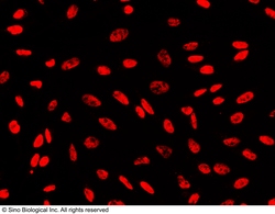 Sino Biological Anti-PAX8 Antibody, Rabbit Polyclonal, Quantity: Each of