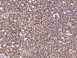 Sino Biological Anti-PCNA Antibody, Rabbit Polyclonal, Quantity: Each of
