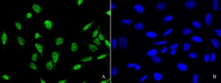 Sino Biological PDCD4 Antibody, Rabbit PAb, Antigen Affinity Purified 100uL,
