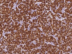 Sino Biological Anti-PDI Antibody, Rabbit Polyclonal, Quantity: Each of