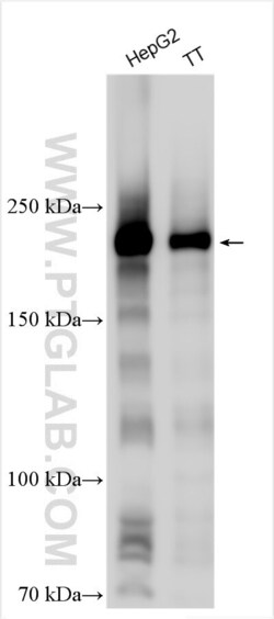 PEG3 Rabbit, anti-Human, Polyclonal, Proteintech Quantity: 150 &mu;L:Antibodies