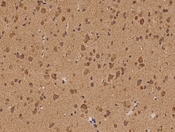 Sino Biological PINK1 Antibody, Rabbit PAb, Antigen Affinity Purified 100µL,