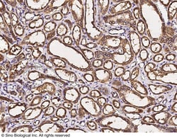 Sino Biological PKLR Antibody, Rabbit PAb, Antigen Affinity Purified 100uL,