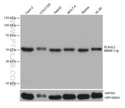 PLAGL2 Mouse, anti-Human, Clone: 3C2E5, Proteintech:Antibodies:Primary