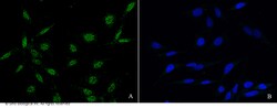 Sino Biological PLK1 / PLK-1 Antibody, Rabbit PAb, Antigen Affinity Purified
