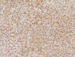 Sino Biological PMVK / phosphomevalonate kinase Antibody, Rabbit MAb 100µL,