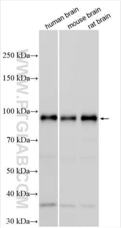 PPM1E Rabbit, anti-Human, Polyclonal, Proteintech Quantity: 150 &mu;L:Antibodies