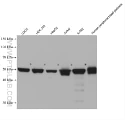 PPM1F Mouse, anti-Human, Clone: 2A2E8, Proteintech Quantity: 150 &mu;L:Antibodies