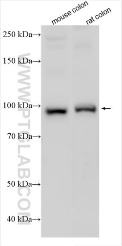 PPP1R12C Rabbit, anti-Human, Polyclonal, Proteintech Quantity: 20 &mu;L:Antibodies